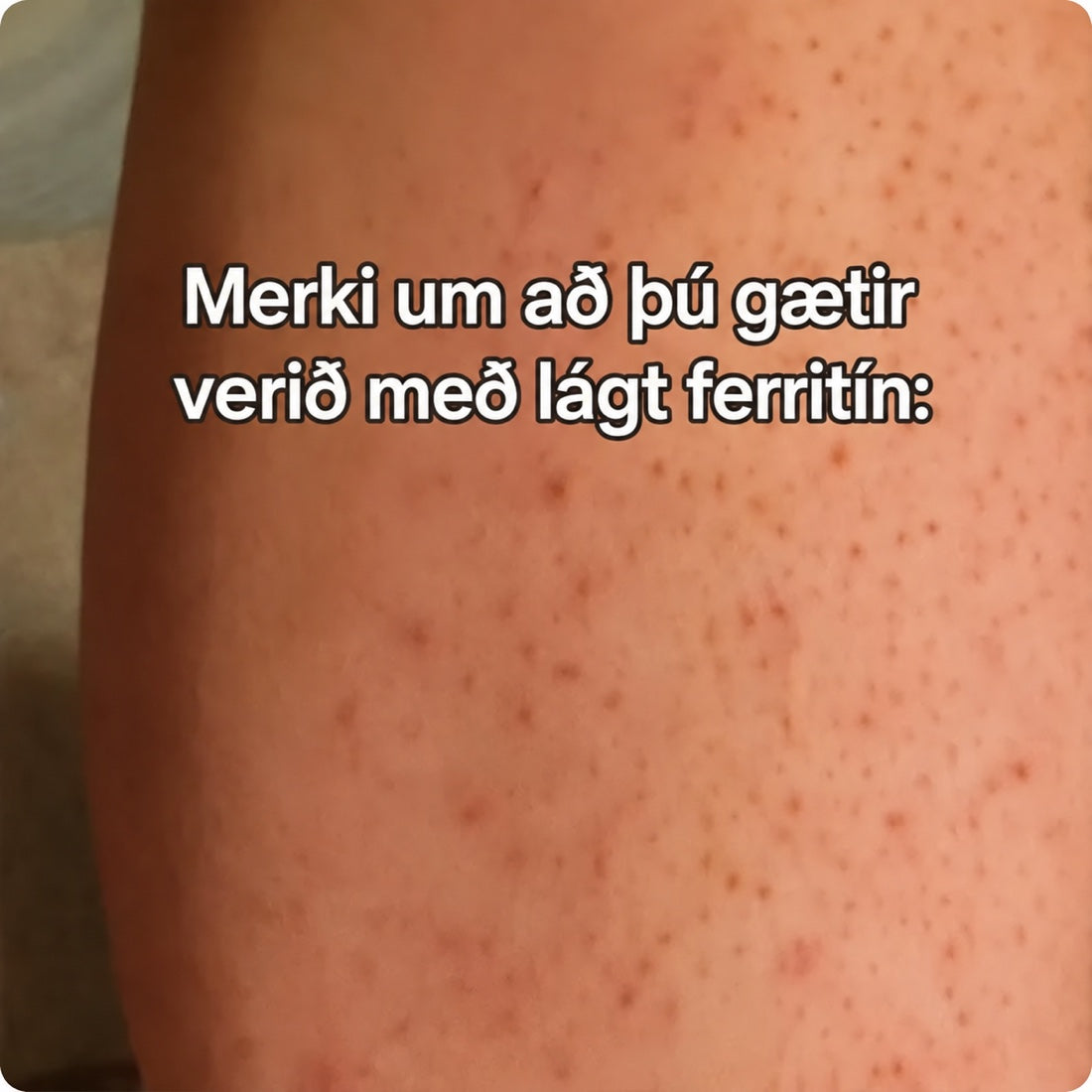 96% þroskaðra kvenna skortir steinefni eða vítamín